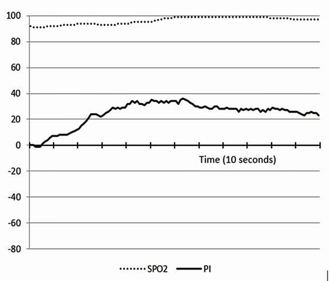 Sensors Insights 3 2017-09-08 Fig4 PI Response to briefly breathing oxygen.